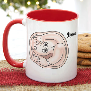 Mom I'm Sorry My Large Head Ruined Your Foo Foo, Personalized Mug, Mother's Day Gift, Gift For Mom - Coffee Mug - GoDuckee